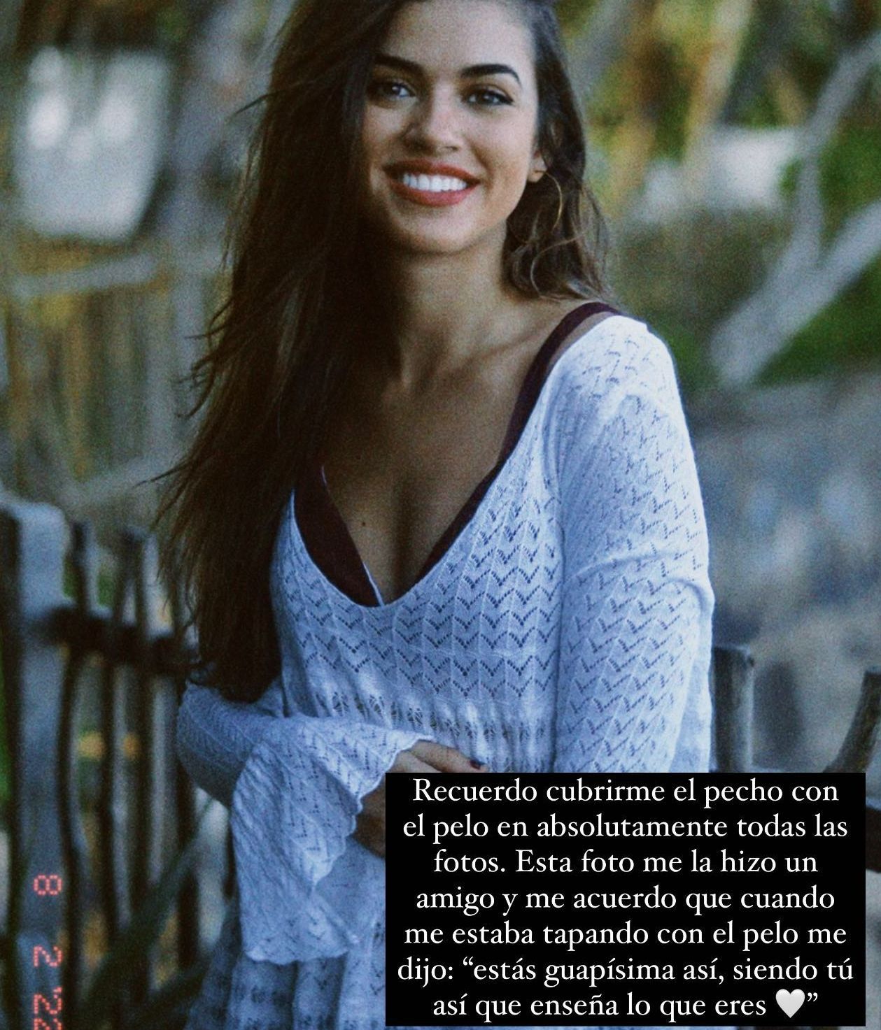 Rocío Camacho habla de su apariencia antes de operarse