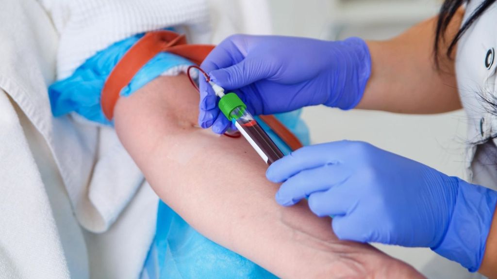 ¿Es posible el contagio de la viruela del mono a través de la sangre?