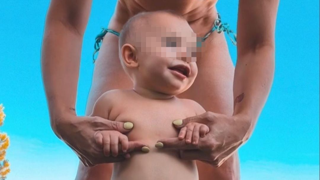 Soraya Arnelas enseña la hernia que su hija pequeña tiene en el abdomen