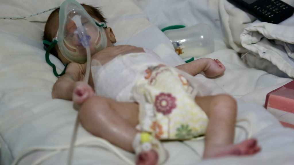 En el hospital Booots de MSF en Helmand, los niños sobreviven a duras penas a base de suero y oxígeno.