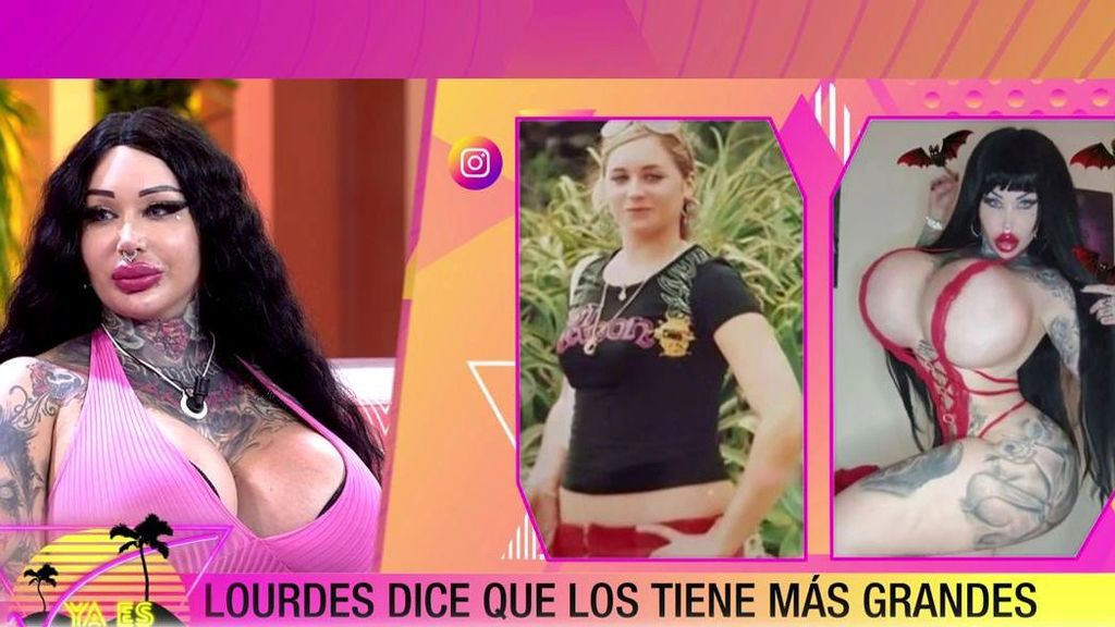 El impresionante antes y después de Lourdes García, la mujer con el pecho más grande de España