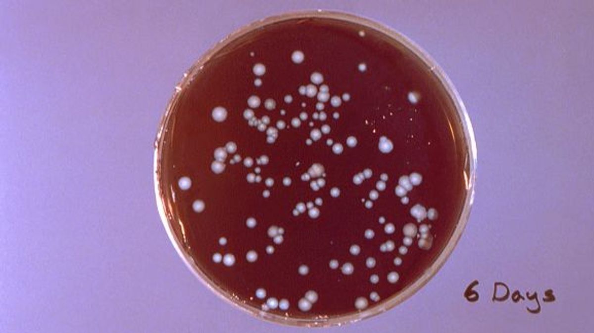 La enfermedad de la legionela: causada por una bacteria que sobrevive con altas temperaturas