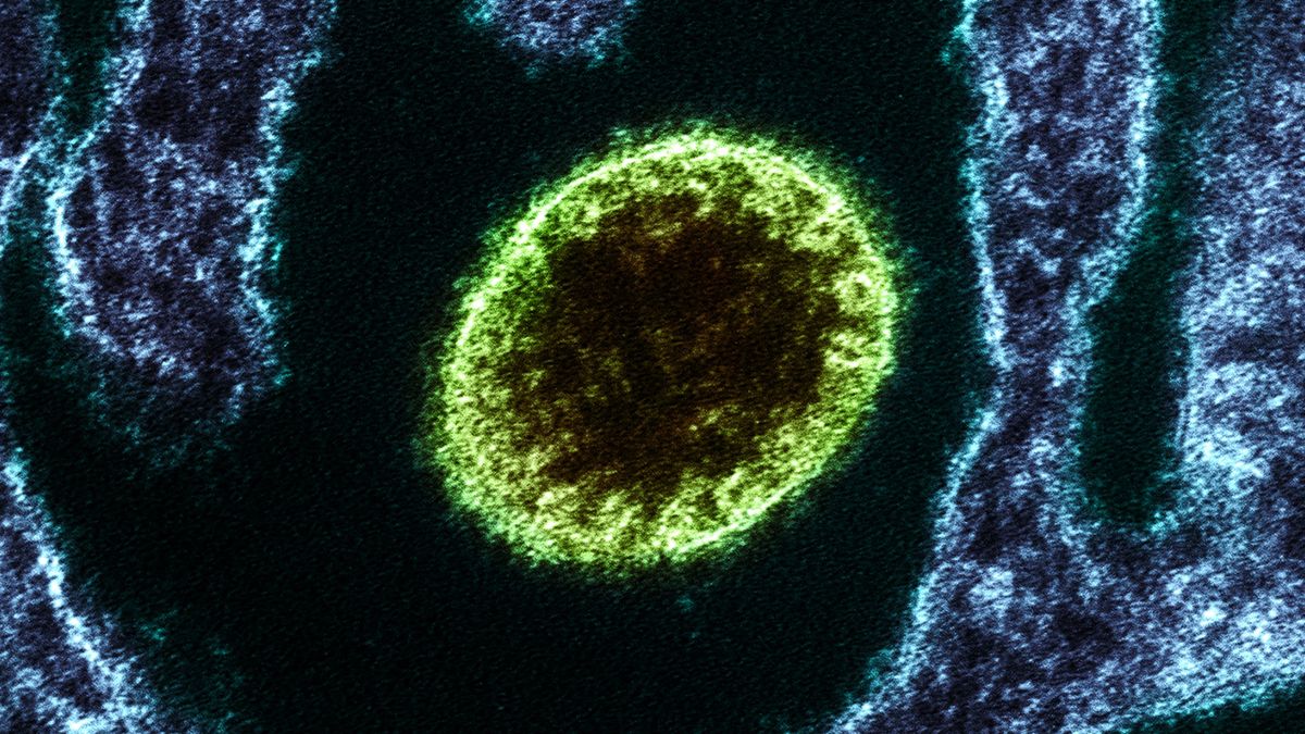 El virus Nipah es otro de los henipavirus como el Langya y el Hendra