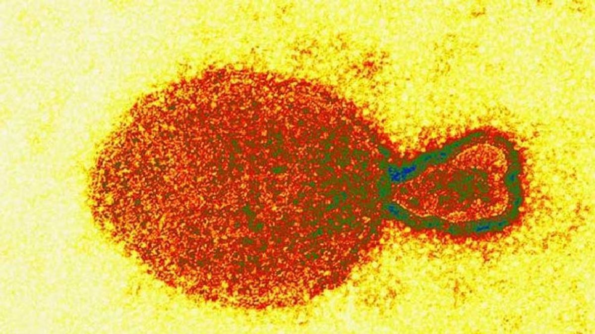 Langya, así es el nuevo virus hallado en China