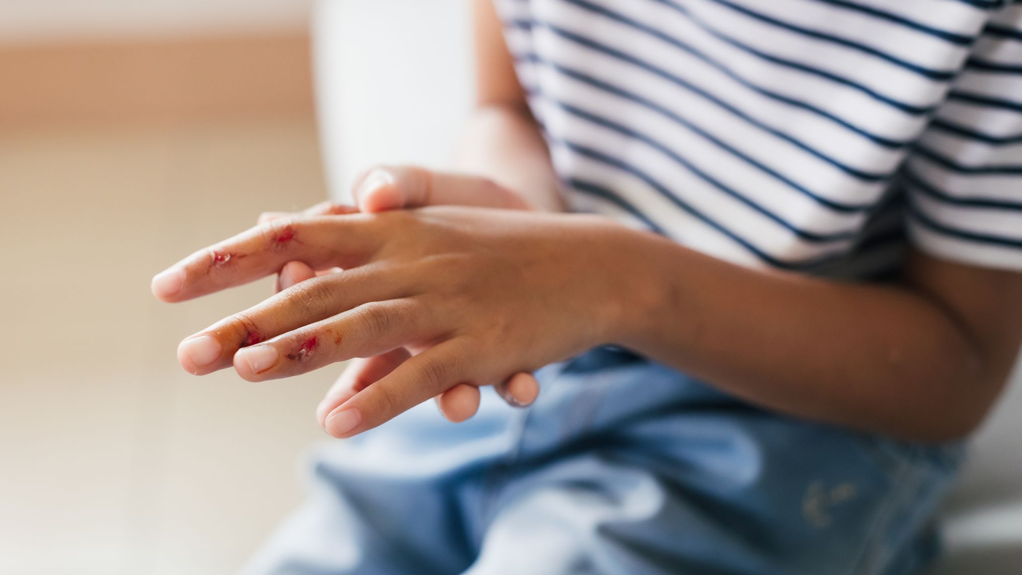 Usos del mentol que te sorprenderán