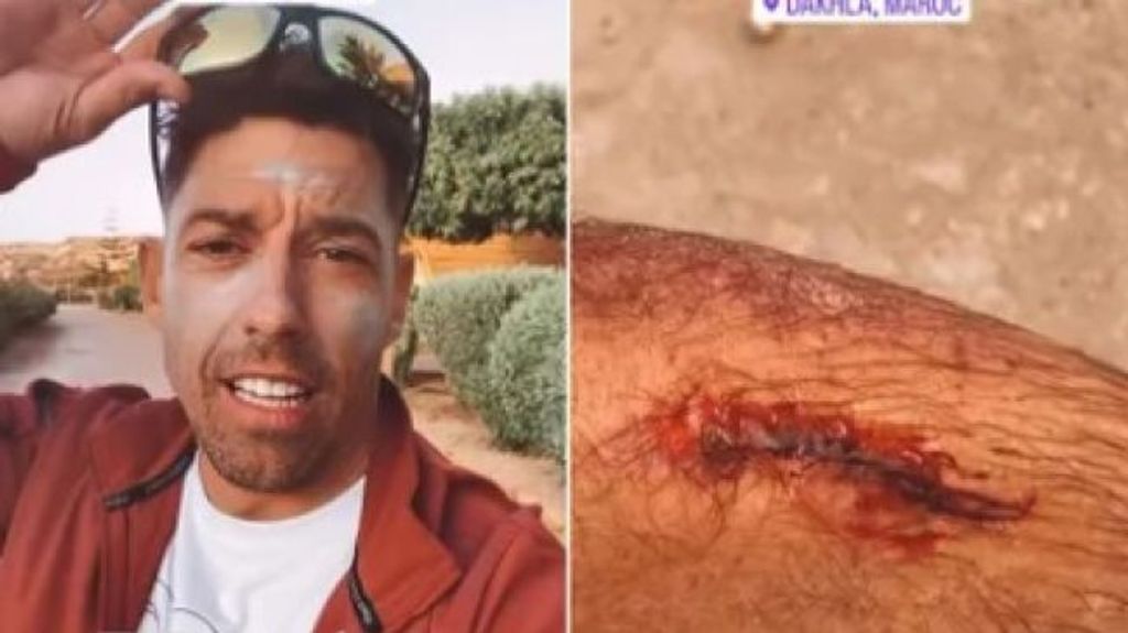Adrián Lastra y la herida provocada por su accidente