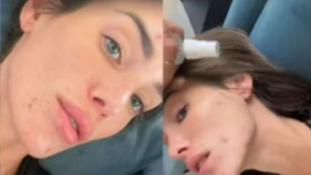 El motivo del brote de acné que ha sufrido Marta López Álamo: "Esto no es normal"