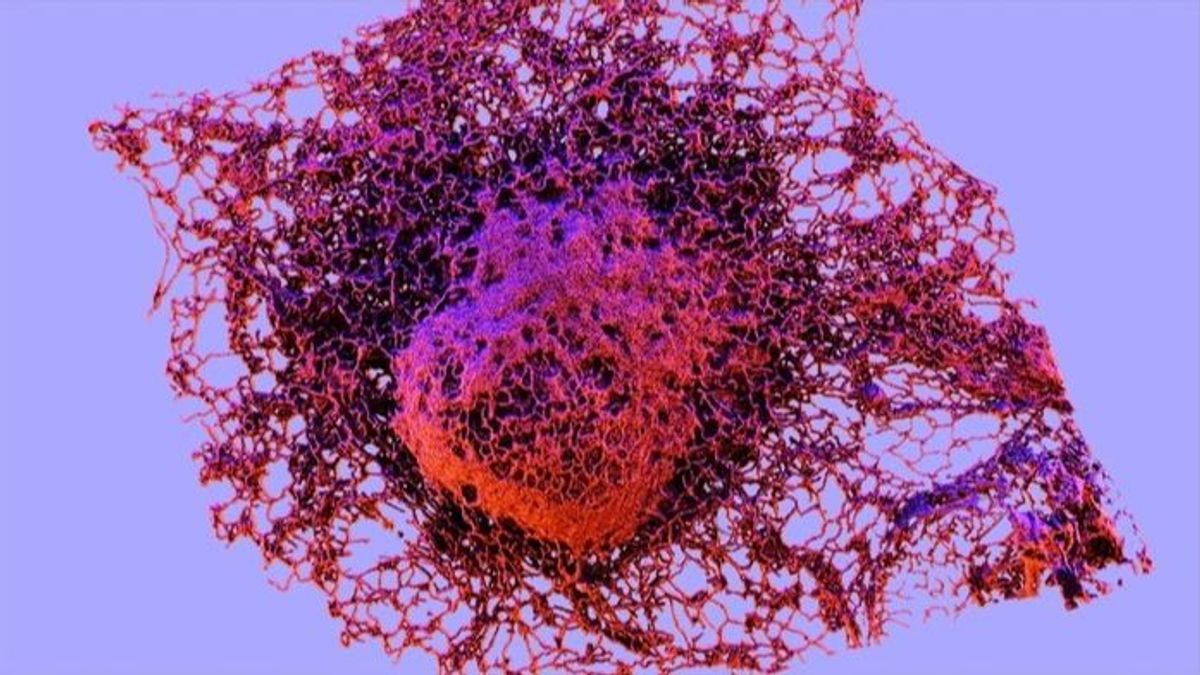 Esta imagen muestra la distribución celular del retículo endoplásmico (en rojo) en las células cancerosas.