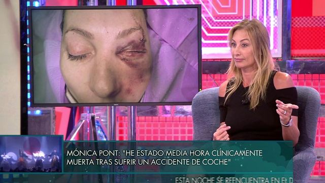 Mónica Pont Reaparece Em Deluxe Após Grave Acidente De Carro Tive