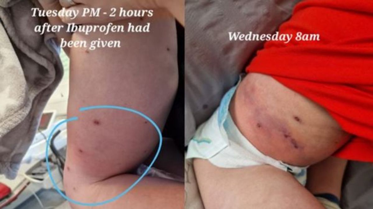 La madre de Tommy ha compartido las imágenes de la evolución del estado de salud de su hijo en Facebook