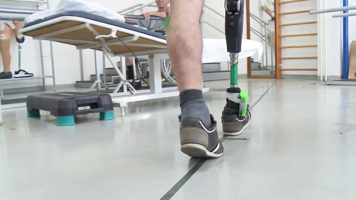 Una persona camina con una prótesis tras amputarle una pierna