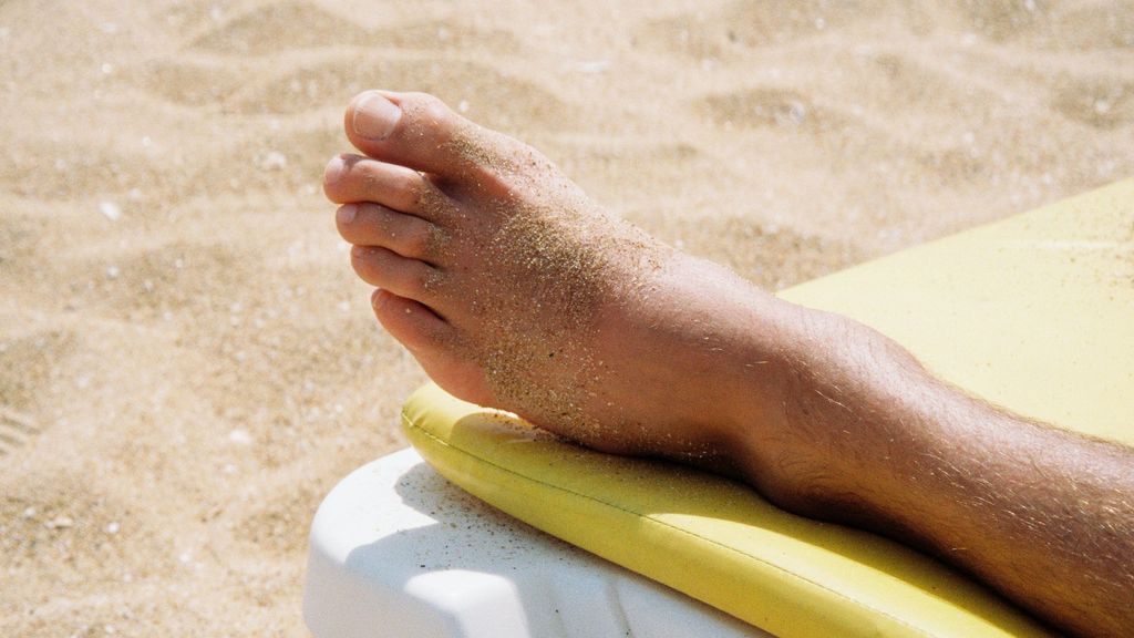 Cómo evitar que la piel se pele después de tomar el sol