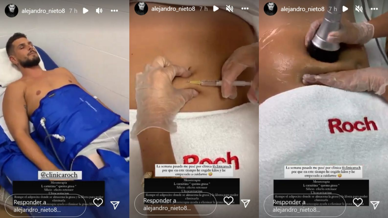 Alejandro Nieto muestra los tratamientos estéticos a los que se ha sometido