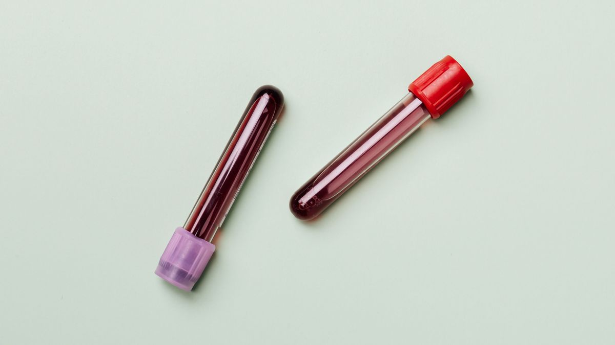 Análisis de sangre Análisis de sangre