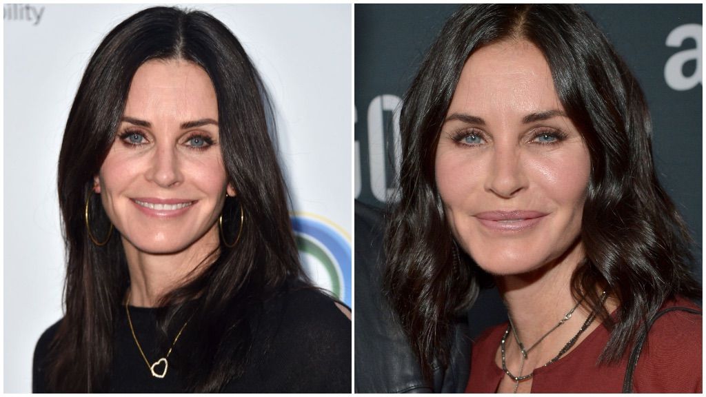 Courtney Cox también se ha sometido a una infinidad de tratamientos.