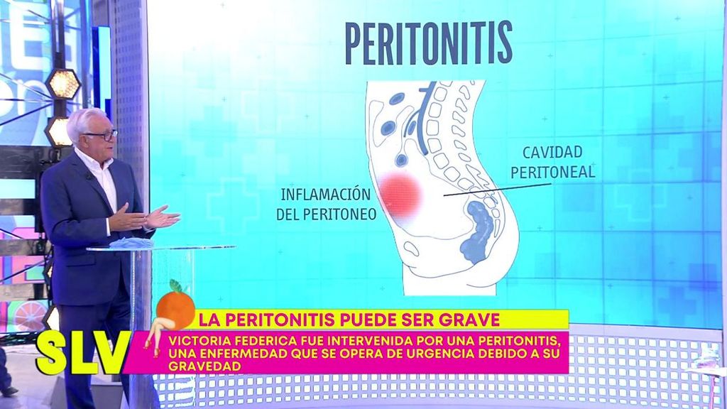 El doctor Sánchez Martos explica qué es la peritonitis y cómo se trata