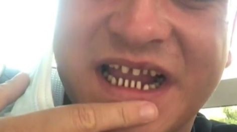 https://album.mediaset.es/eimg/2022/09/15/el-consejo-general-de-dentistas-advierte-de-los-riesgos-de-someterse-en-turquia-a-tratamientos-denta_9a5e.jpg