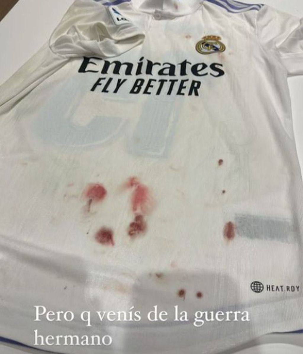 Mina Bonino se asusta al ver la camiseta de Fede Valverde llena de sangre tras el derbi: "Pero qué venís, de la guerra"