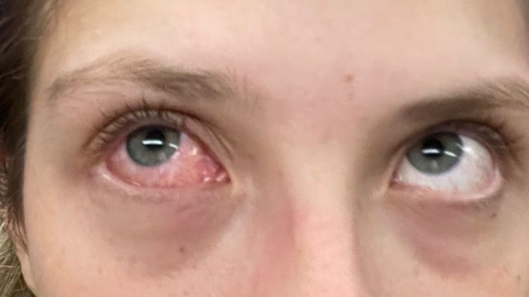 Anita Matamoros comparte el diagnóstico de su enfermedad tras terminar la noche en urgencias