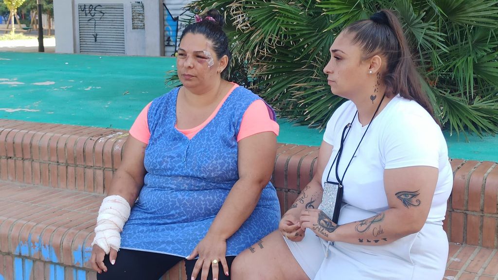 La mujer atropellada ya ha sido dada de alta