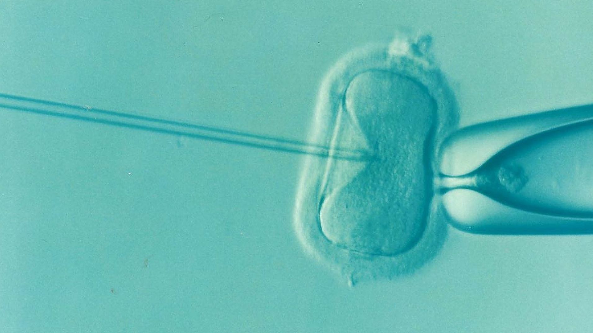 Detect a future schizophrenia in an embryo?  The ethical limits of pre-pregnancy genetic testing