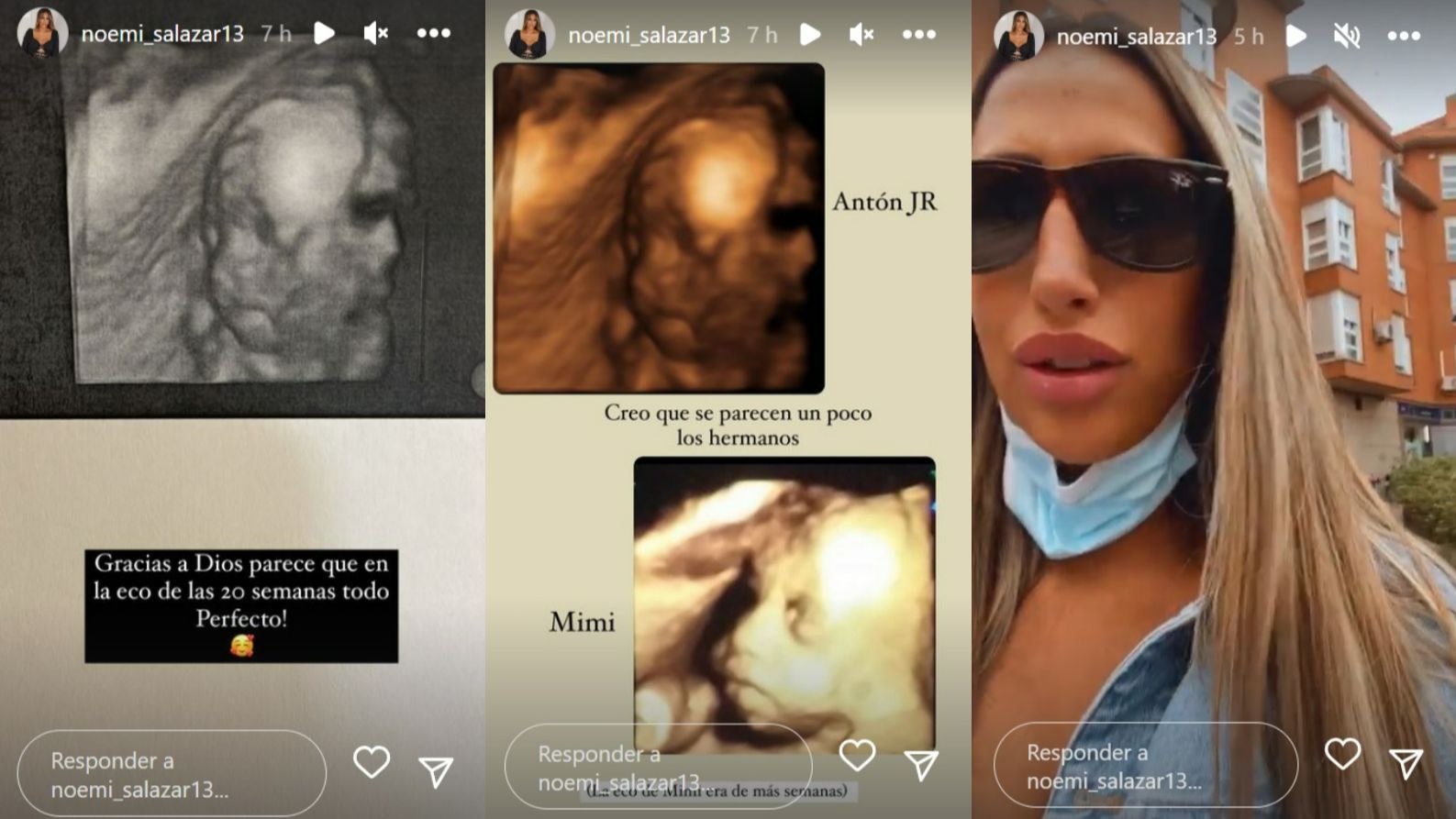 Noemí Salazar ya se ha hecho la ecografía de las 20 semanas