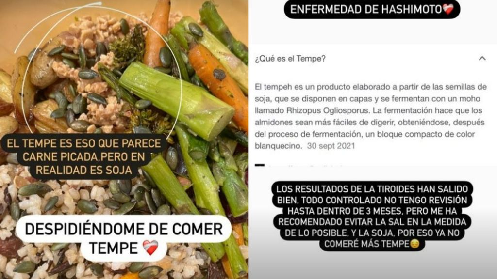 Violeta Mangriñán cuenta que debe eliminar el tempeh de su dieta