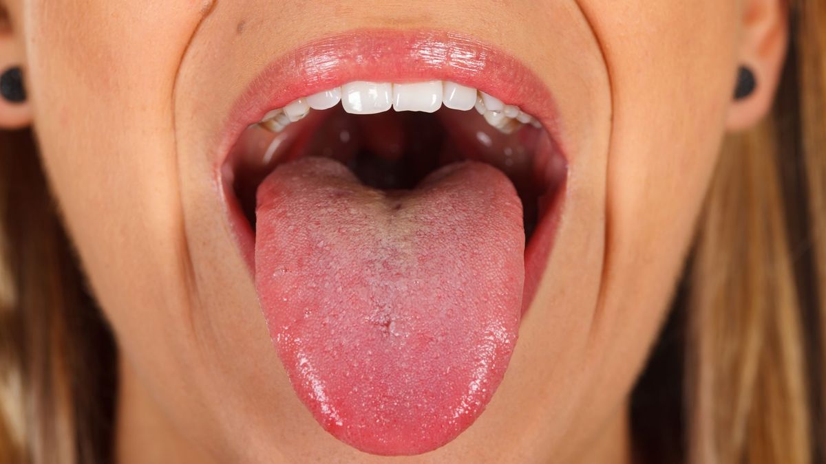 La importancia de lavarse la lengua