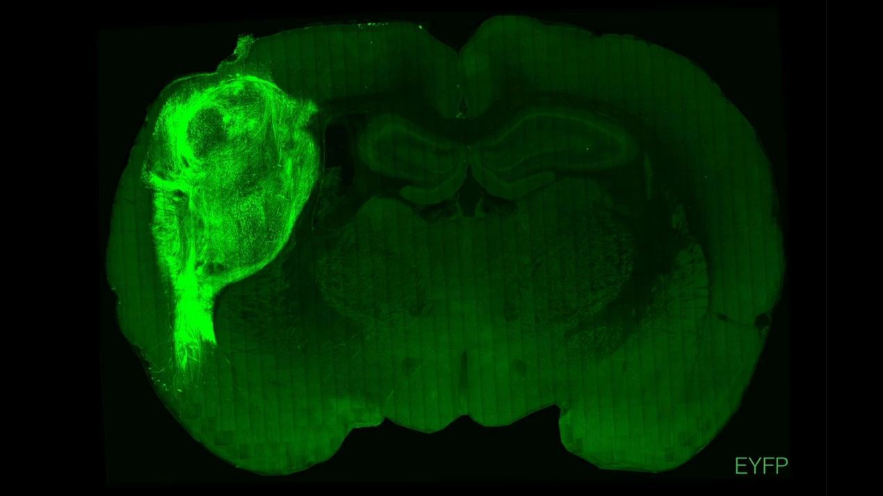 Implantan "minicerebros" derivados de células humanas a ratas recién nacidas