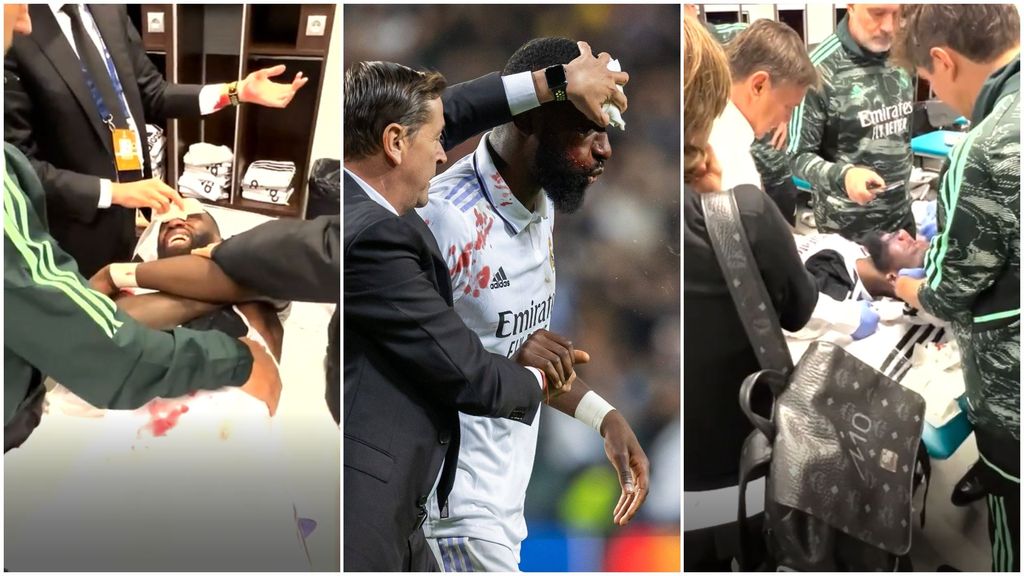 La intervención a Rüdiger desde dentro: del grito de Modric a un Kroos que no podía ni mirar