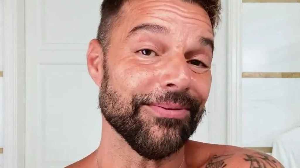 El peligroso truco de belleza de Ricky Martin que está cabreando a los dermatólogos (play)