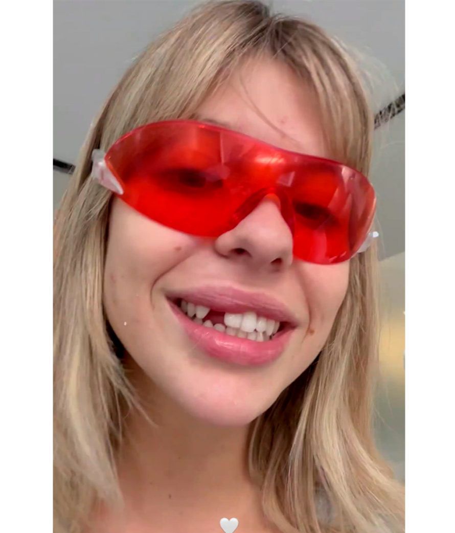 Anita Matamoros muestra su boca con la pieza dental que le falta