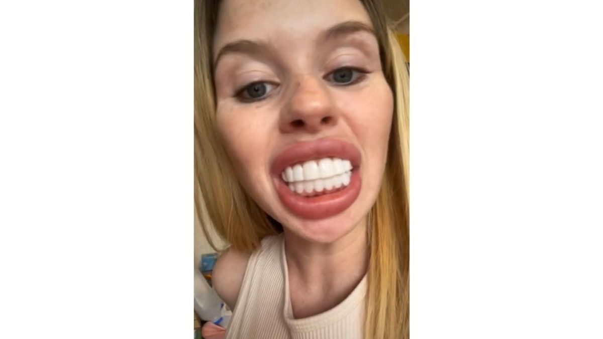 Una joven muestra indignada la sonrisa que le han dejado en el dentista