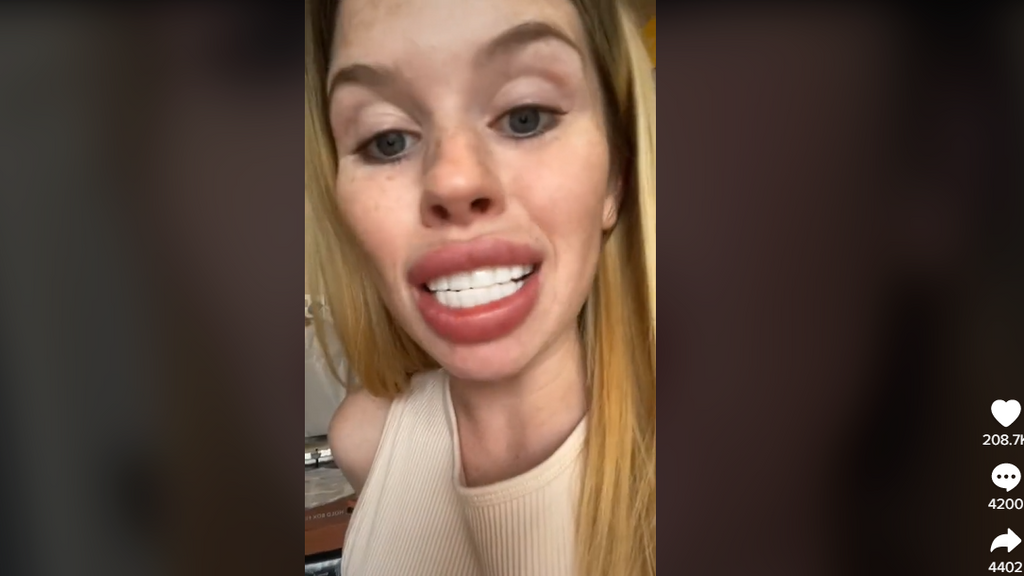 "Dientes de caballo".