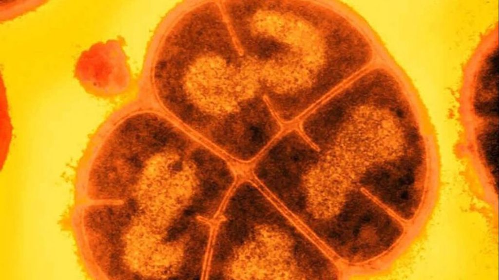 Deinococcus radiodurans