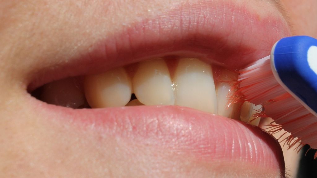 dientes dentadura