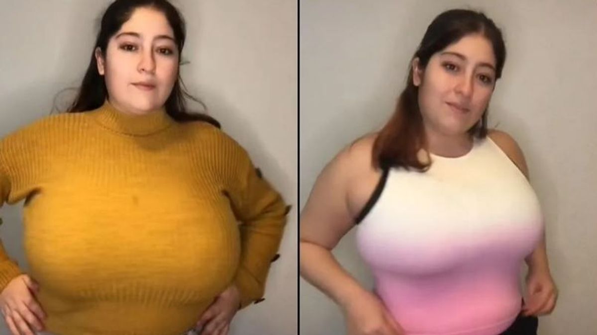 Se vuelve viral la transformación de una joven tras una reducción de pecho