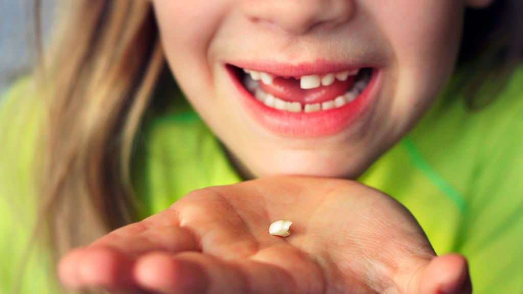 Imagen de archivo de una niña sin dientes