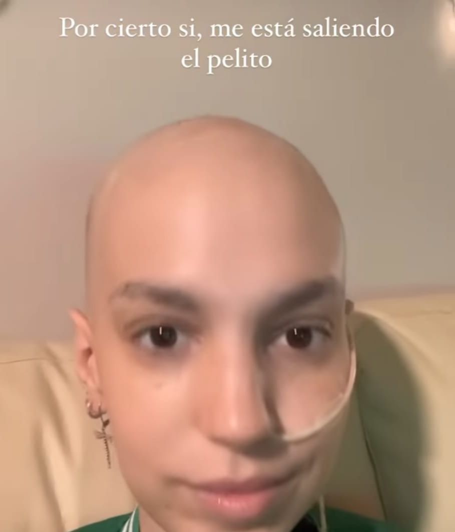 A Elena Huelva le sale pelo