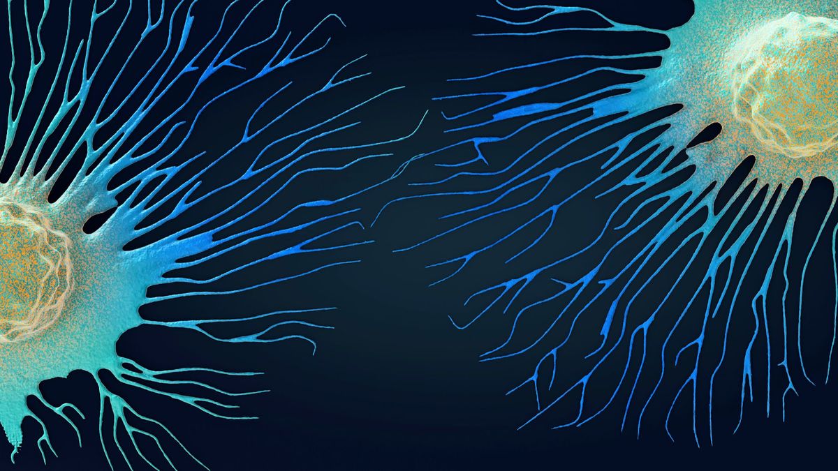 Científicos españoles descubren las células responsables de la recaída del cáncer de colon