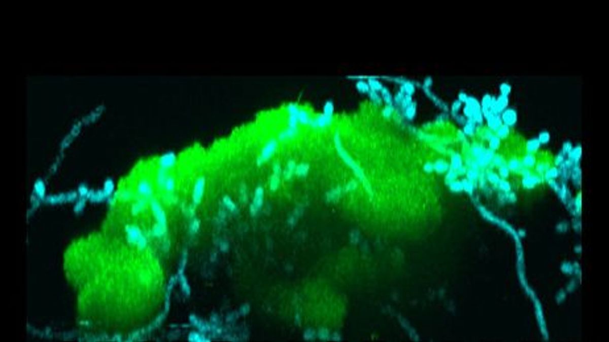 Imagen de la combinación de un hongo Candida albicans (azul) y bacterias Streptococcus mutans (verde)