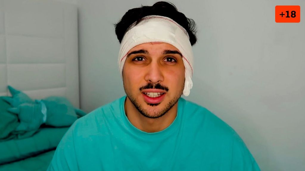 Darío Sellés se somete a su tercera operación de orejas y enseña el resultado (1/2)
