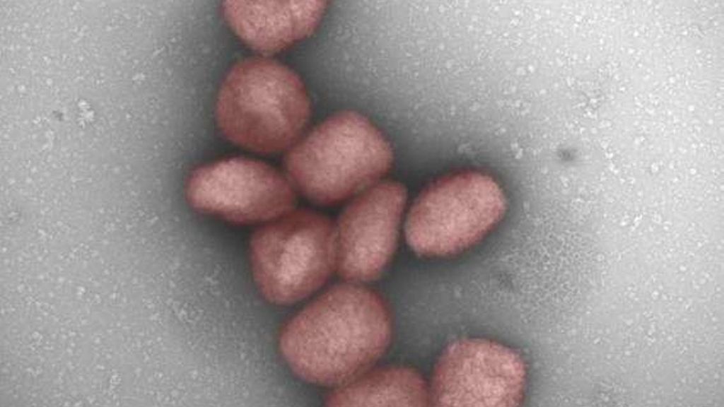 Un estudio del CSIC muestra la presencia del virus de la viruela del mono en el aire de pacientes infectados