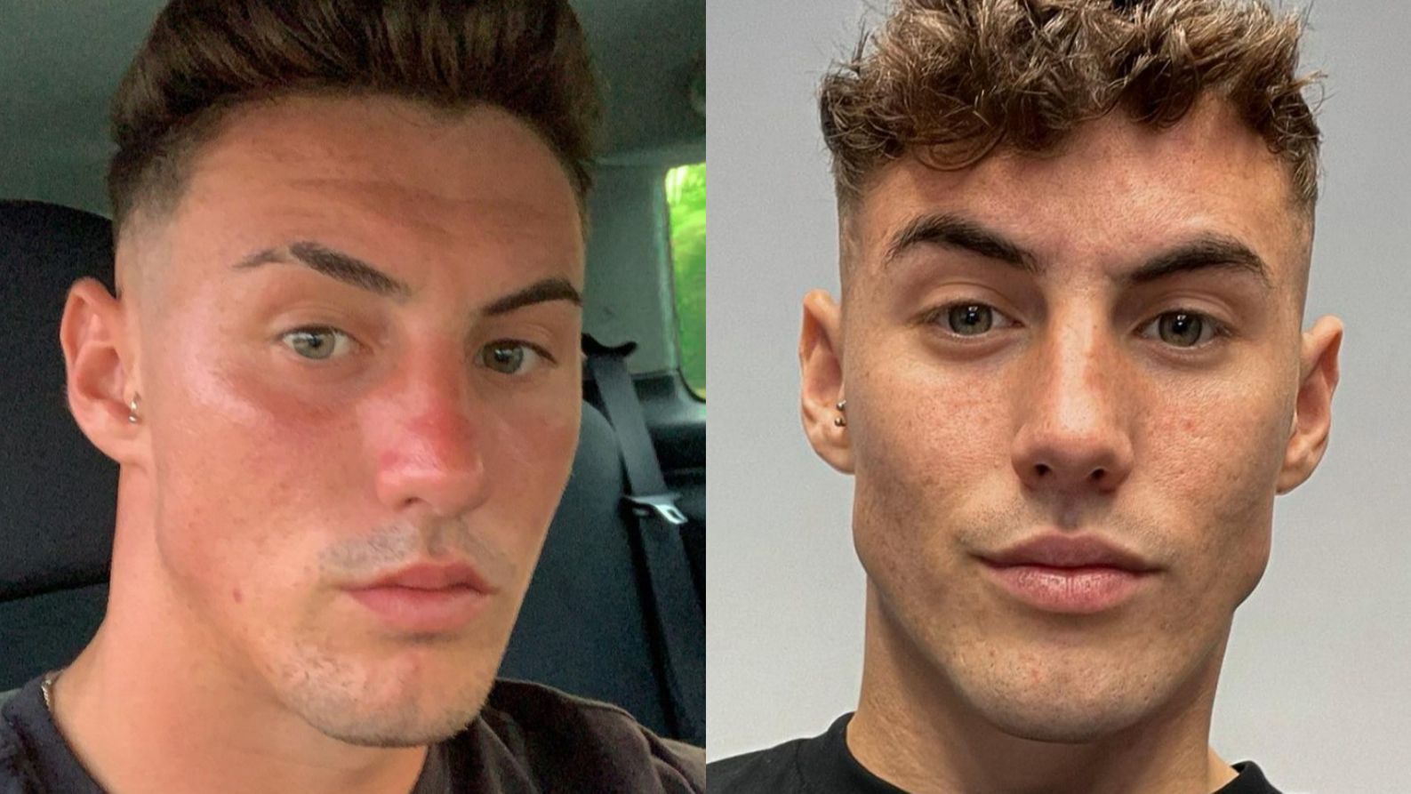 El antes y el después de Álvaro Boix