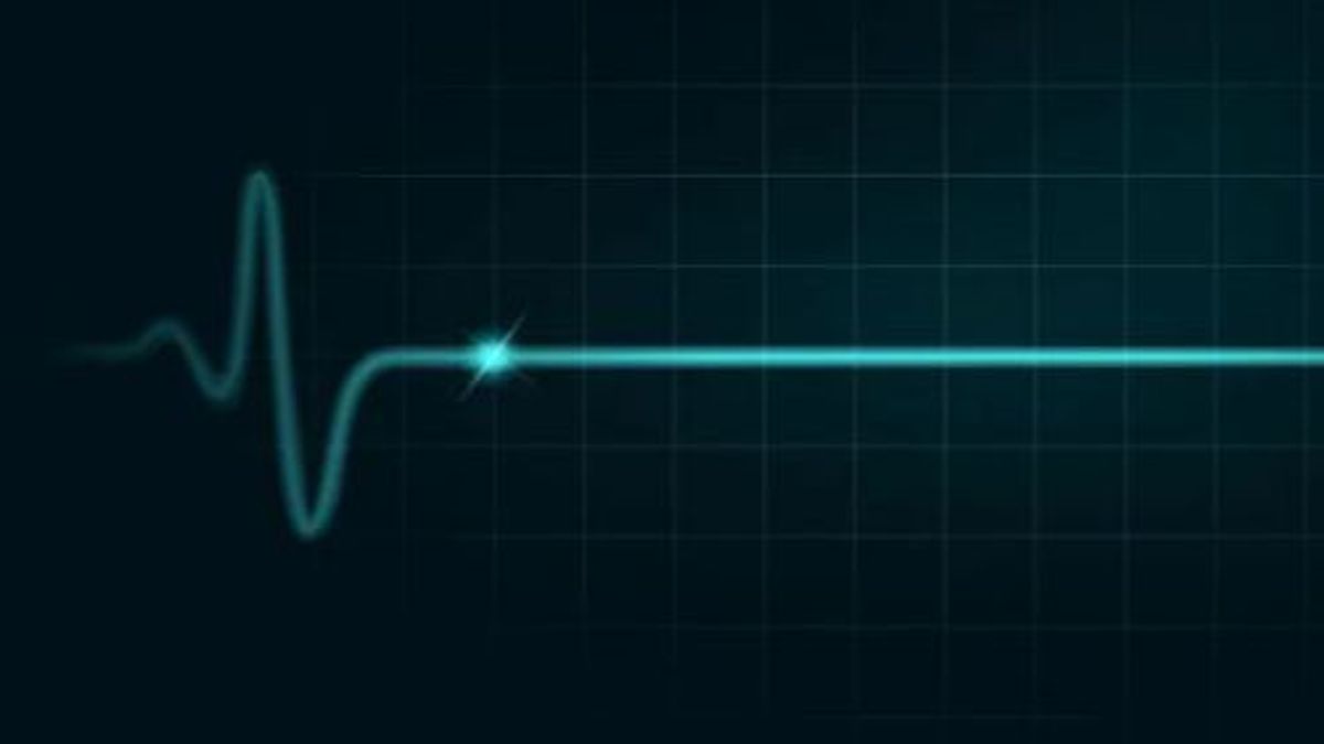 línea cardiaca línea cardiaca
