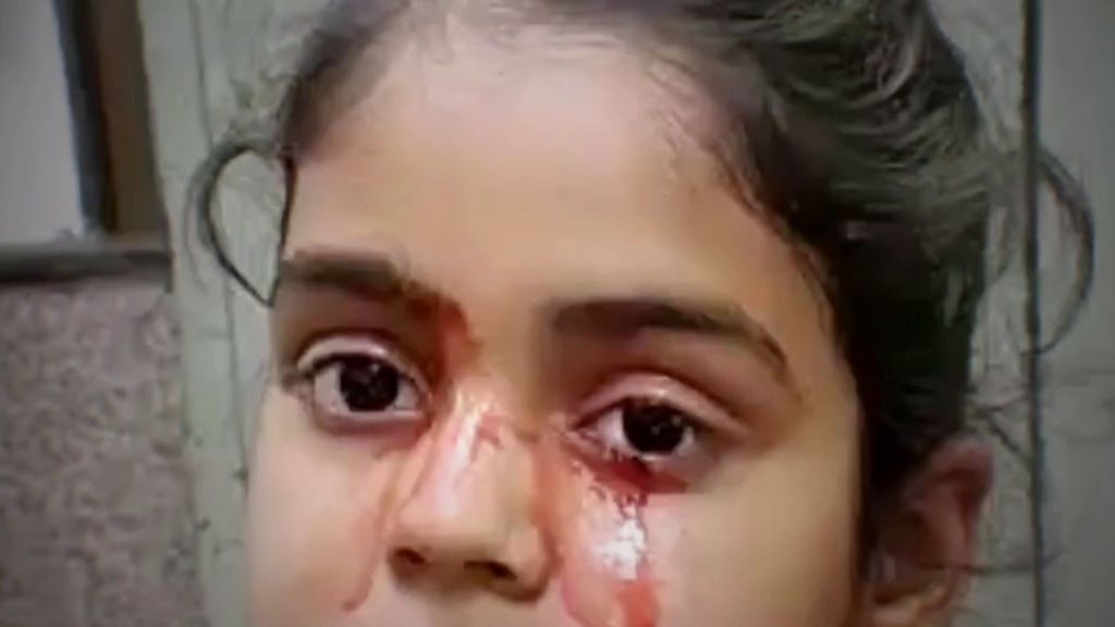 ¿Por qué llora sangre esta niña?