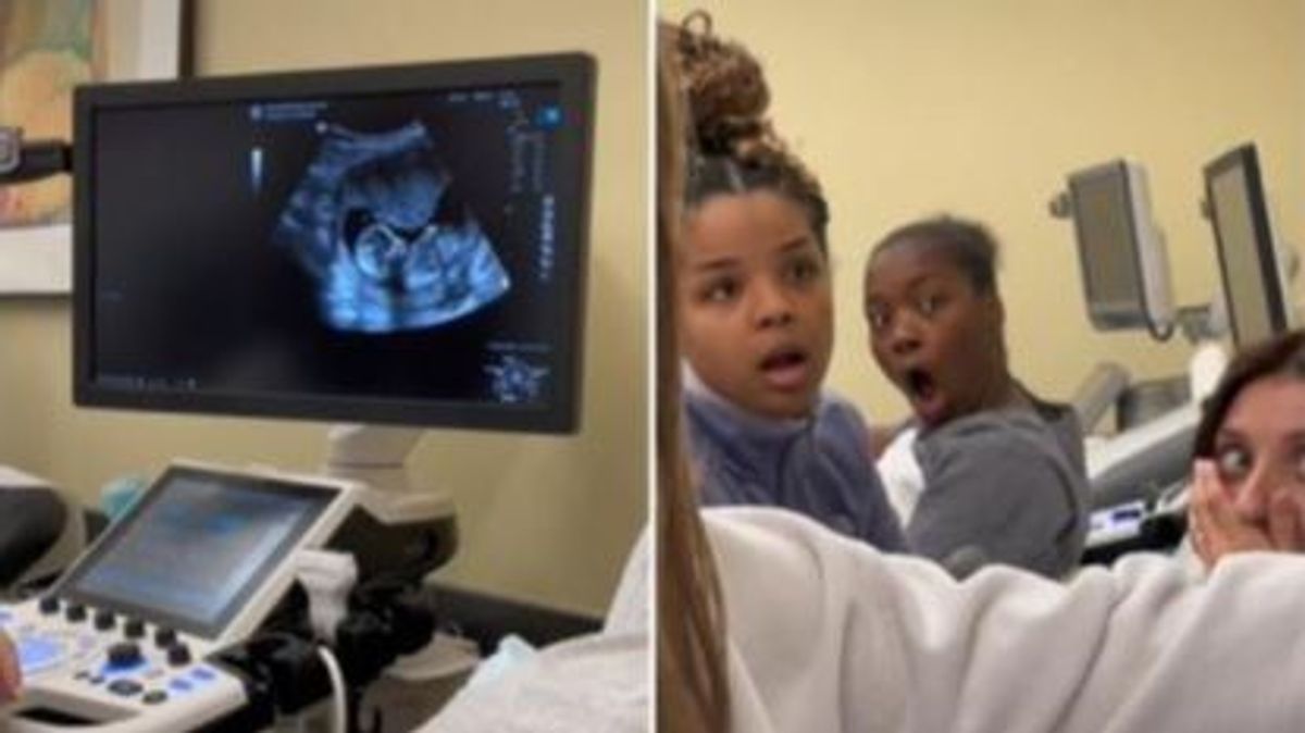 Una clase de ginecología se hace viral por el embarazo 'desconocido' de una alumna