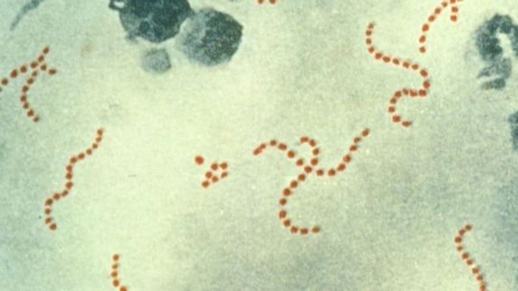 Archivo - Bacteria 'streptococcus pyogenes'