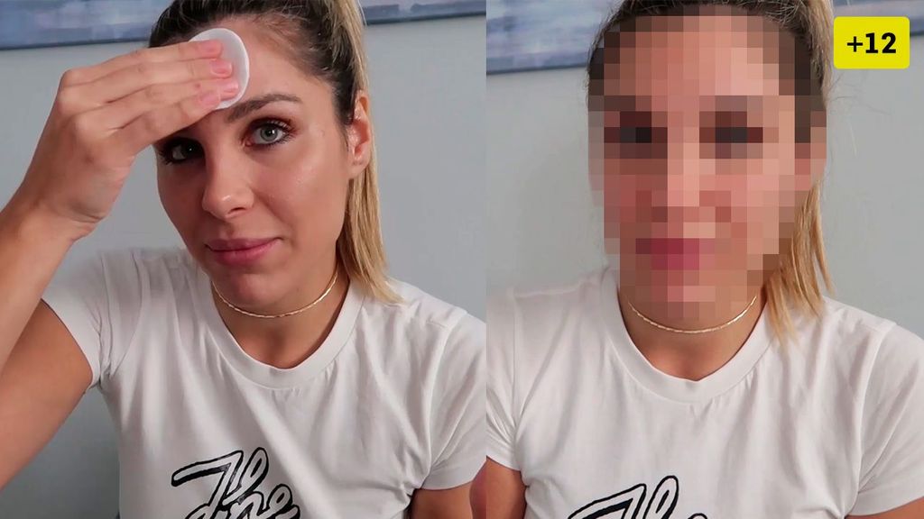 Ivana Icardi enseña su rostro sin nada de maquillaje, tras sufrir un brote de acné (2/2)