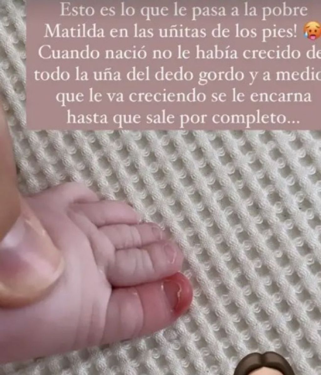 Marta Pombo muestra el dedo del pie de su hija Matilda